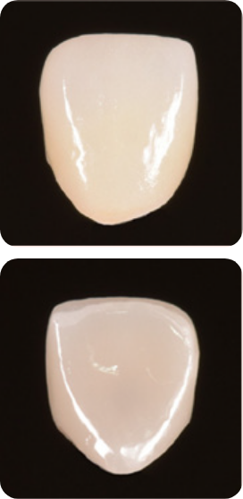 ジルコニアをベースにセラミックを築盛して作製（自由診療）