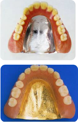 チタンや金をはじめとした貴金属で作製（自由診療）